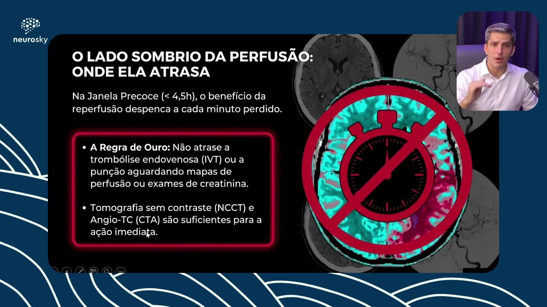 Guideline de AVC Isquêmico