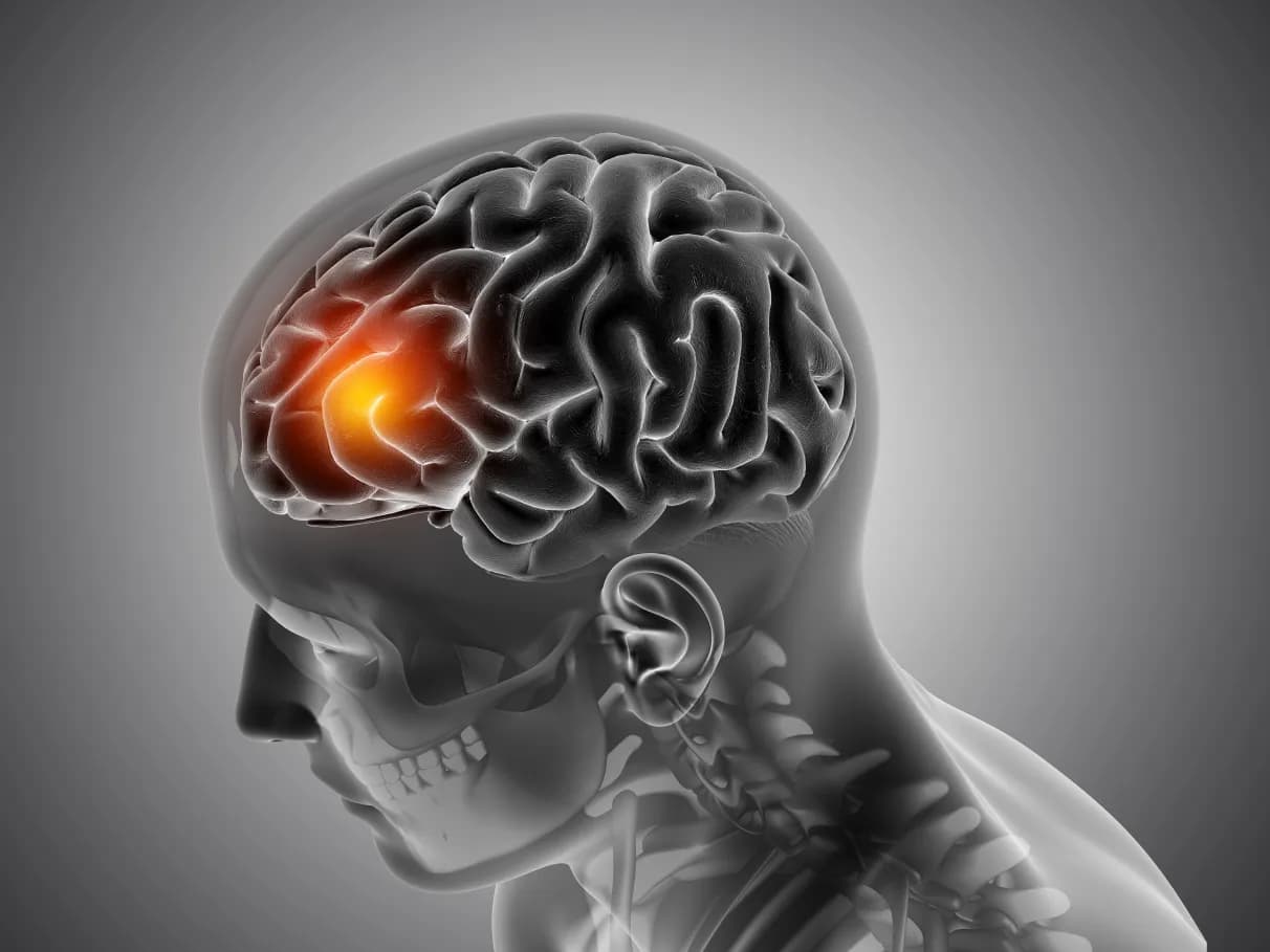 Core isquemico realmente importa? Metanalise e revisão sistemática dos trials recentes