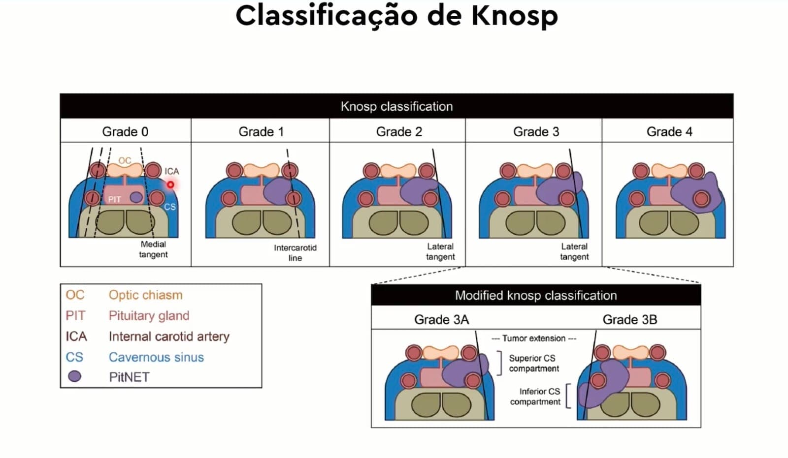 Knosp - Aula #1