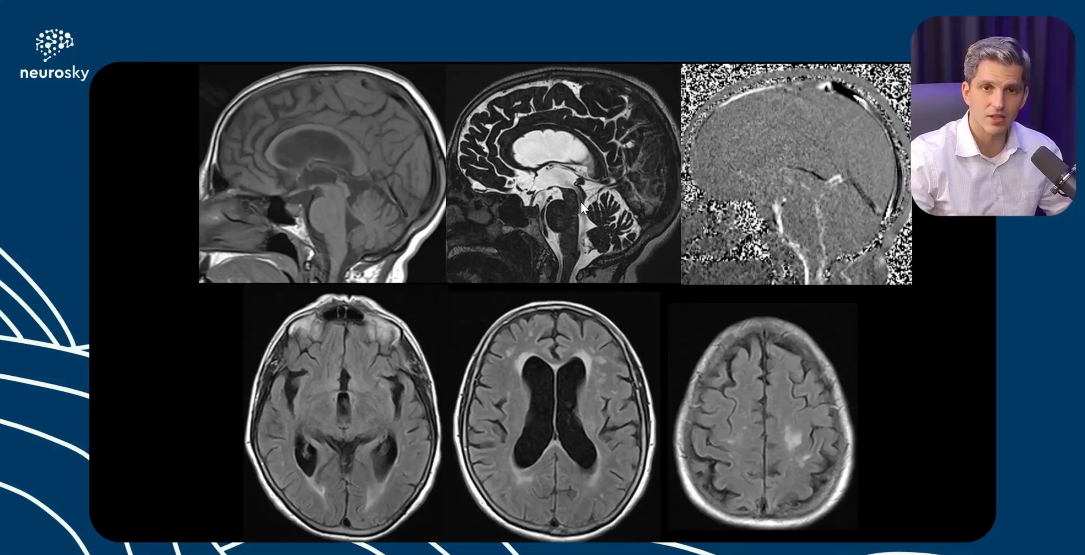 Protocolos de Exames de Neuroimagem - Parte 2