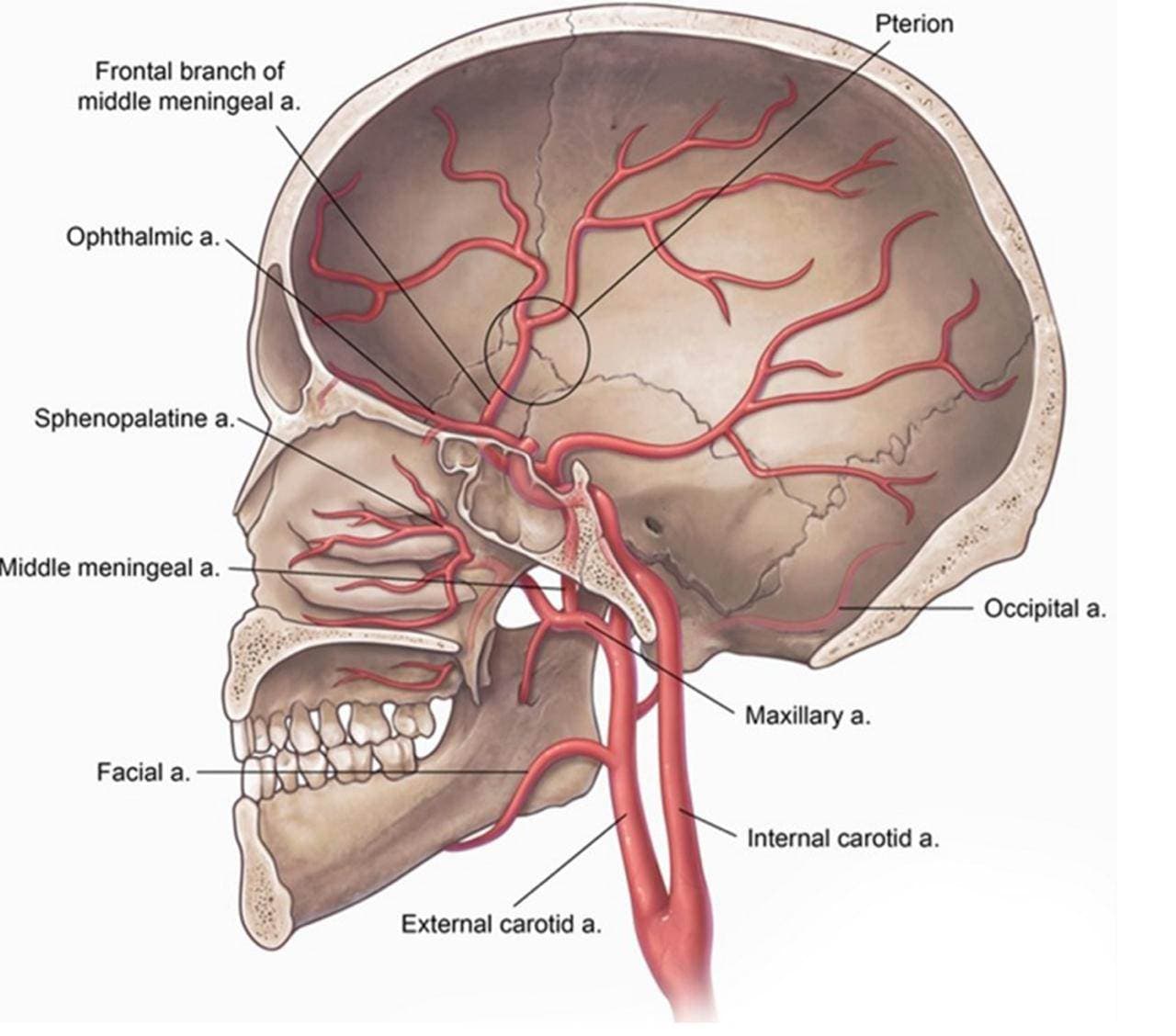 Embolização de Artéria Meningea Média no Hematoma Subdural